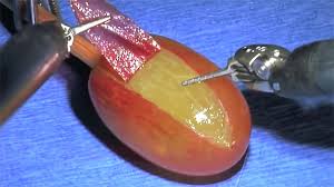 They Did Surgery on a Grape (2018)